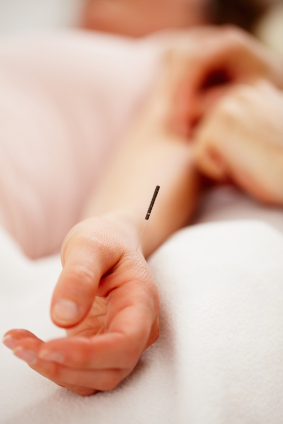 Akupunktur am Handgelenk